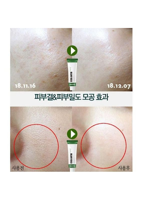 Medi-Peel Восстанавливающий крем для лица с экстрактом центели Cica Antio Cream 30 ml — Крем, Южная Корея (358499797)