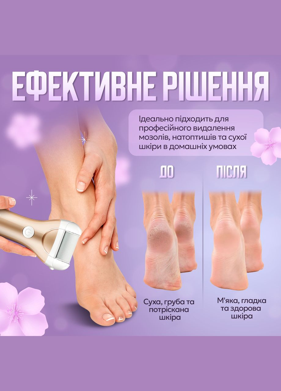 Комплект змінних насадок для роликової пемзи, 3 шт (ZCA-3) No Brand (347590321)