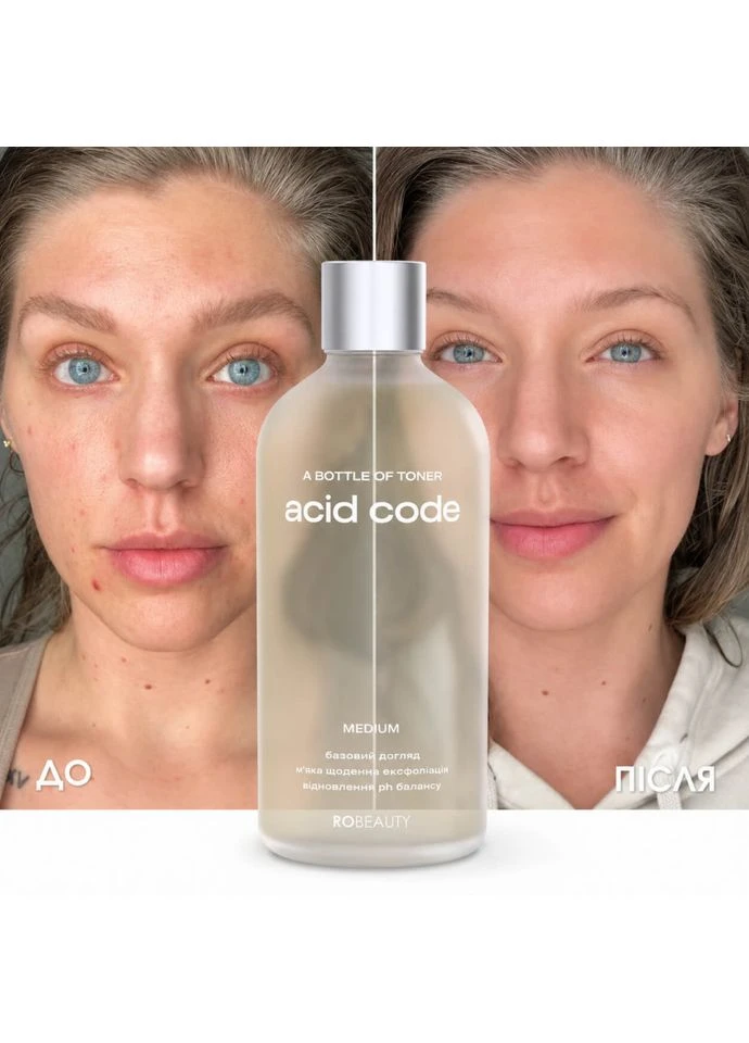 RoBeauty Кислотный тоник для лица Acid Code Medium 100 мл — Крем, Украина (399529708)
