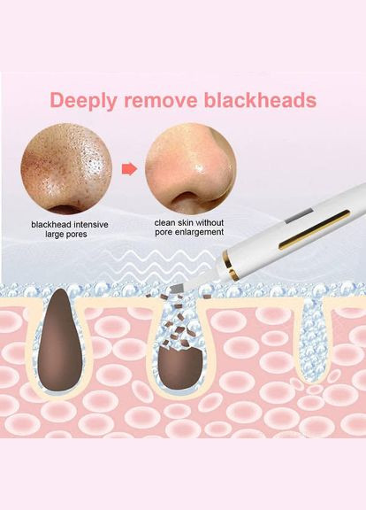 Ультразвуковий скребок для шкіри обличчя, пілінг, видалення чорних цяток, глибоке очищення обличчя, лопатка для пор Anskin (300373380)