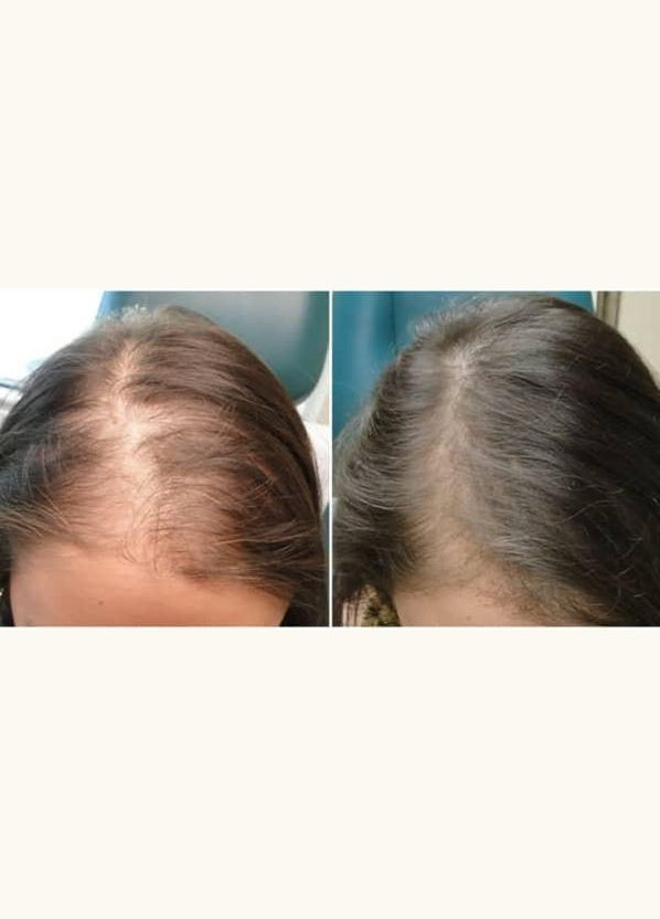 Акція "Комплекс проти випадіння волосся Hair System" J'erelia (315817766)