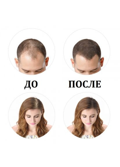 Кератиновая пудра для волос для коррекции проблемных зон (залысин) 27,5 г (Light Brown) Toppik (282960196)