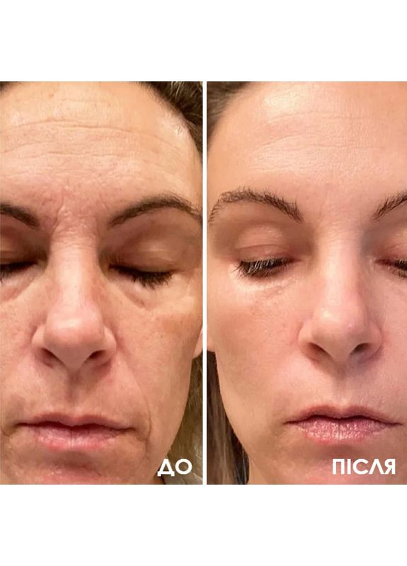 RoBeauty Крем-замінник ботоксу Argireline 50 мл — Крем, Україна (361071964)