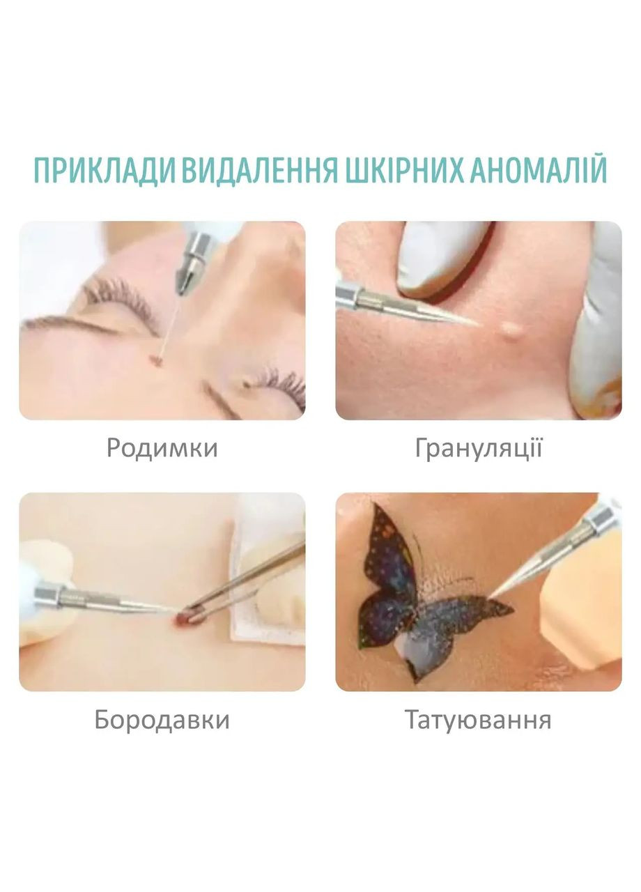 Электрокоагулятор Beauty для удаления папиллом и бородавок плазменная ручка белая Swan YP03 (304274171)