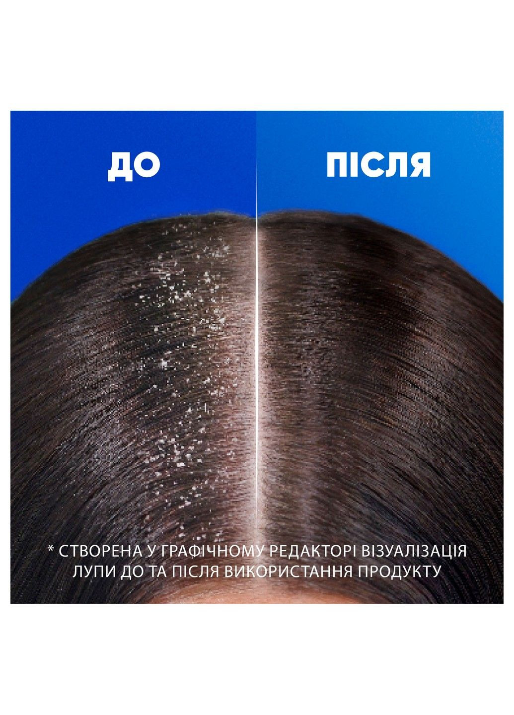 Шампунь проти лупи Основний догляд 800 мл Head & Shoulders (304485126)