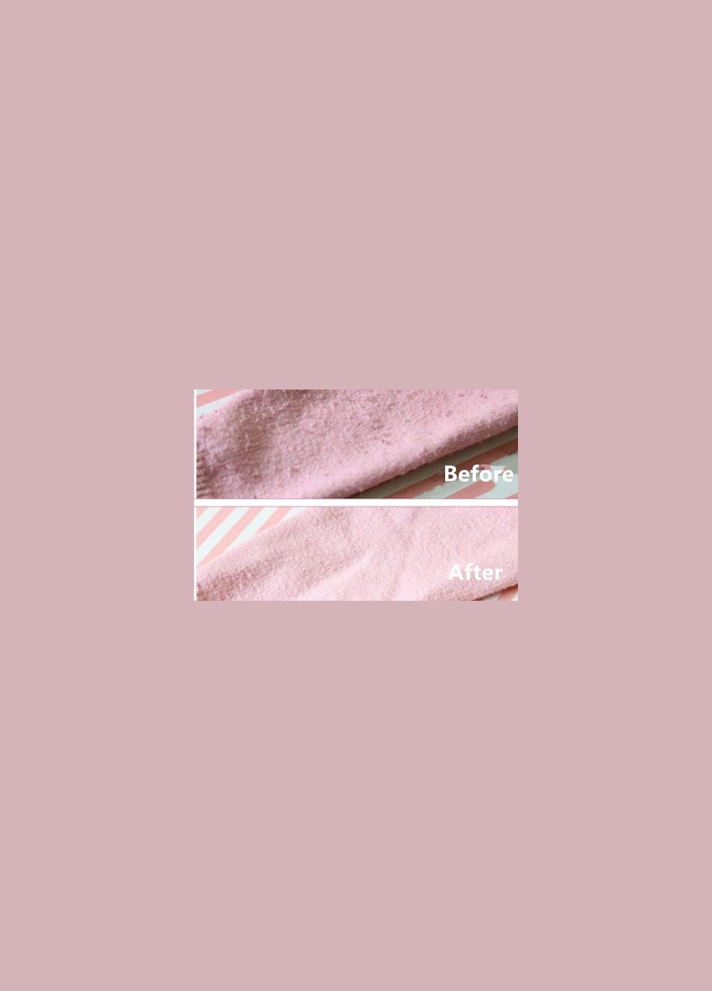 Машинка для удаления катышек (ковтунов) Xiaomi Lint Remover White MQXJQ01KL MiJia (300524052)