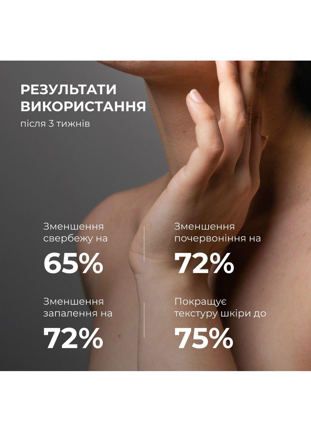 Hillary Лосьйон-детокс для проблемної шкіри з саліциловою кислотою Anti-Acne Salicylic Body Lotion 150 мл — Крем, Україна (333828455)