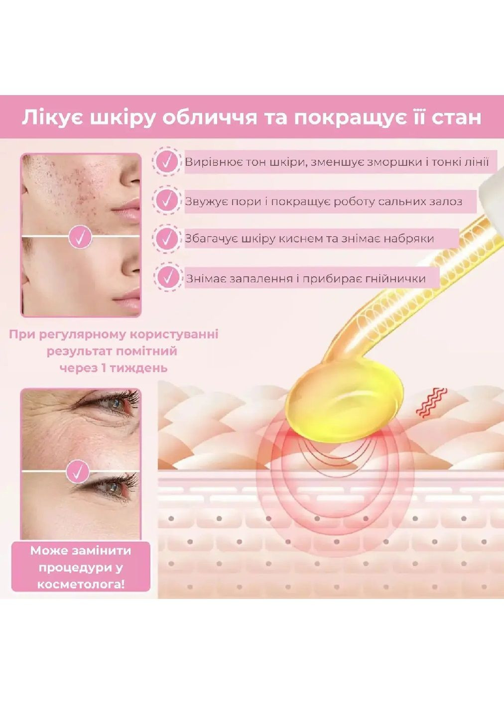 Дарсонваль высокочастотный аппарат для ухода за кожей лица волосами с регулятором напряжения насадками 4 штуки (479714-Prob) Unbranded (322953348)