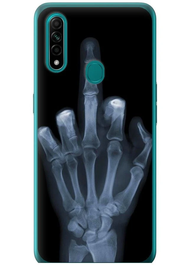2D пластиковий чохол 'Рука через рентген' для Endorphone Oppo A31 (379756184)