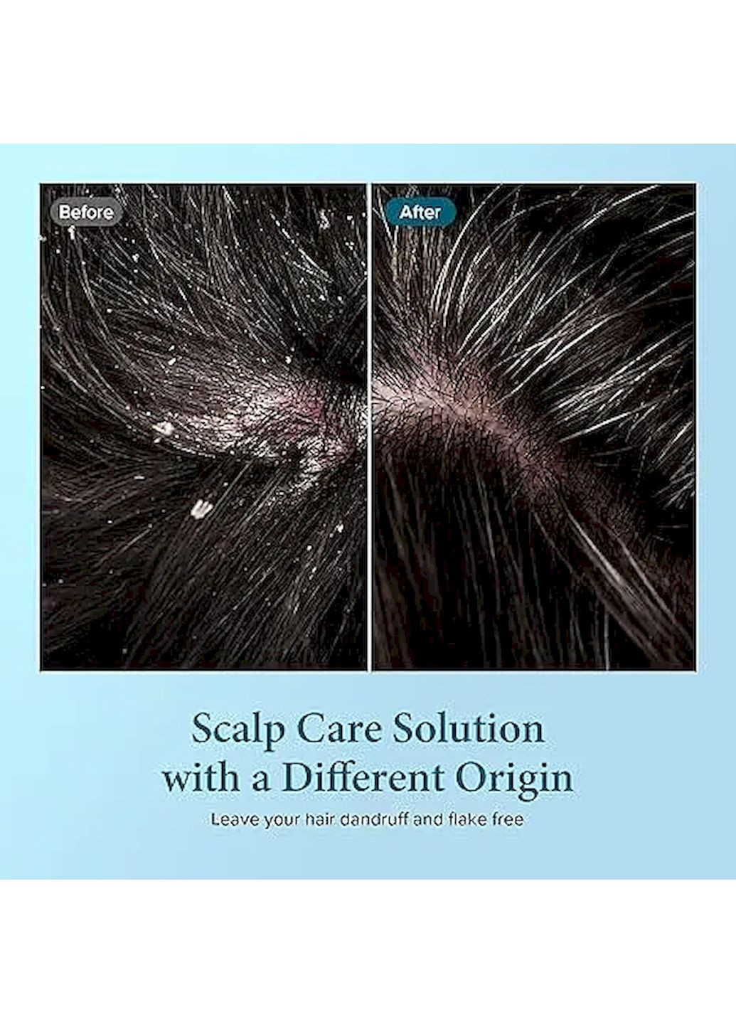 Шампунь Dandruff Relief Shampoo White Musk з ароматом білого мускусу 500 мл Kundal (314774498)