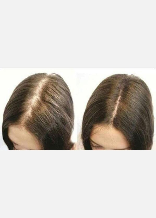 Акція "Комплекс проти випадіння волосся Hair System" J'erelia (315817766)