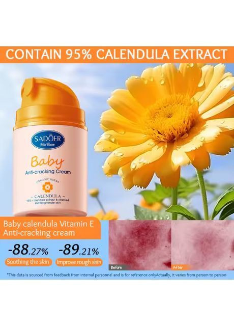 Заспокійливий дитячий крем від обвітрювання з календулою та вітаміном Е Calendula 50 грам SADOER (373273877)