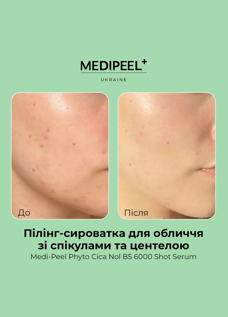 Пілінг- сироватка для обличчя зі спікулами та центелою 6000 Phyto Cica-Nol B5 6000 Shot Serum, 50 мл Medi-Peel (322068556)