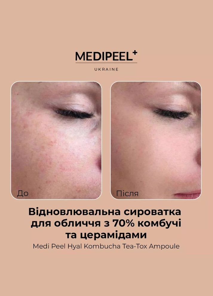 Medi-Peel Сироватка для обличчя Hyal Kombucha Tea-Tox Ampoule відновлювальна з 70% комбучі 50 мл — Крем, Південна Корея (333654501)