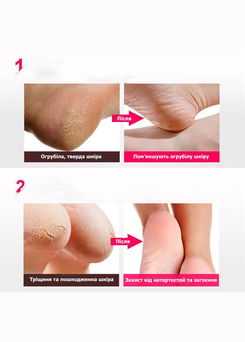 Силіконові підп'ятники від мозолів та тріщин для покращення стану стопи бежеві No Brand (314872853)