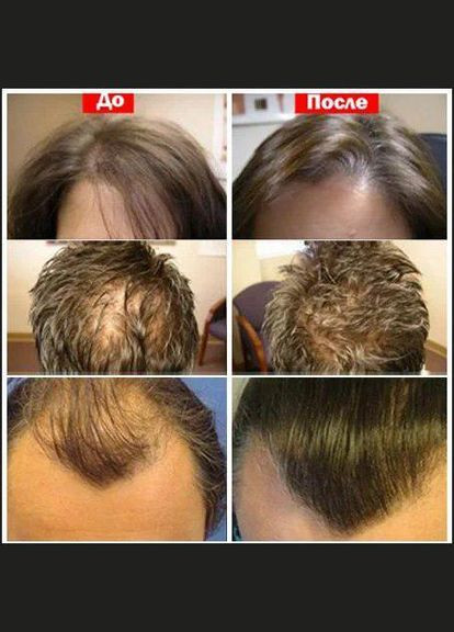 Скраб для кожи головы и масло для кончиков волос. J'erelia (315818345)