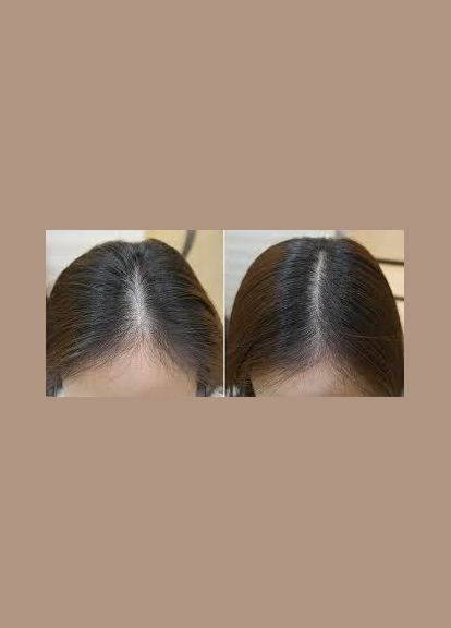 Акція "Комплекс проти випадіння волосся Hair System" J'erelia (315817766)