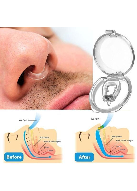 Від хропіння пристрій, зручний затиск на ніс для сну та спокою вночі та вдень, унісекс, 4 штуки набір No Brand (365285204)