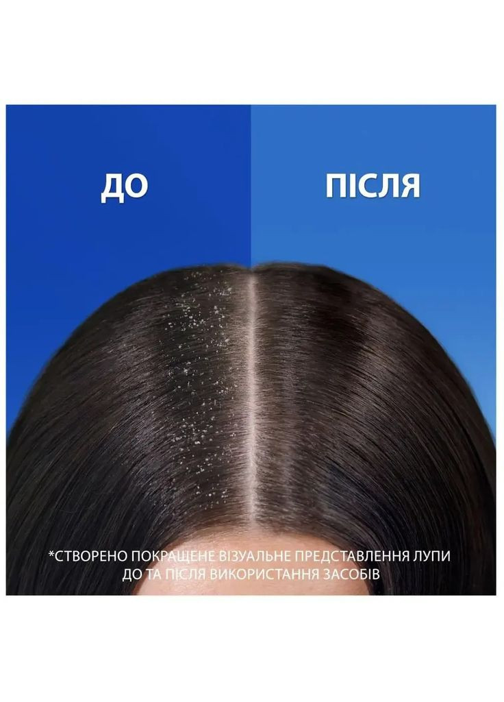 Шампунь проти лупи та бальзам-ополіскувач Head & Shoulders Основний Догляд 2 в 1, 360 мл Head&Shoulders (328398427)