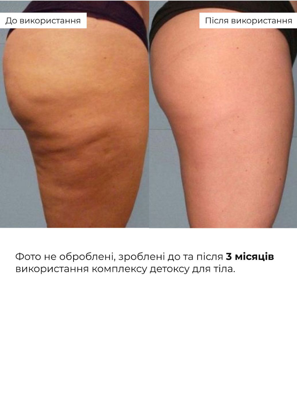 Комплекс детокса для тела Body Detox Complex Hillary (322767359)