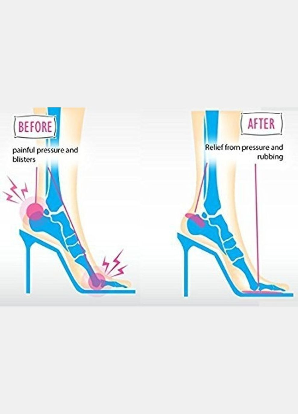 Силиконовые Гелевые Подушечки под подъем свода стопы S6, 1 пара (507514) Clefers (301872327)