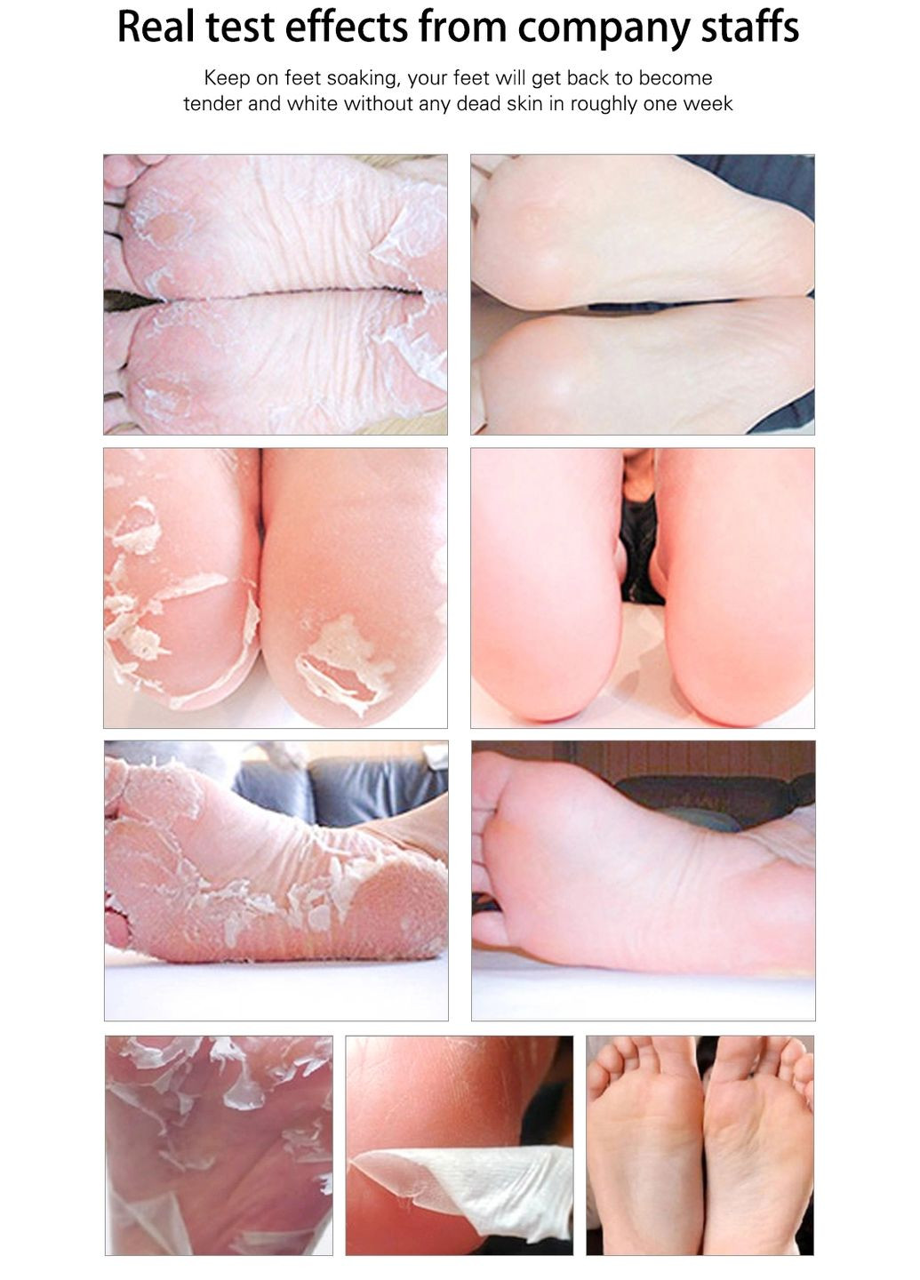 Маска-пилинг для ног Foot Peel Mask Vitamin C 40 г LANBENA (307061064)