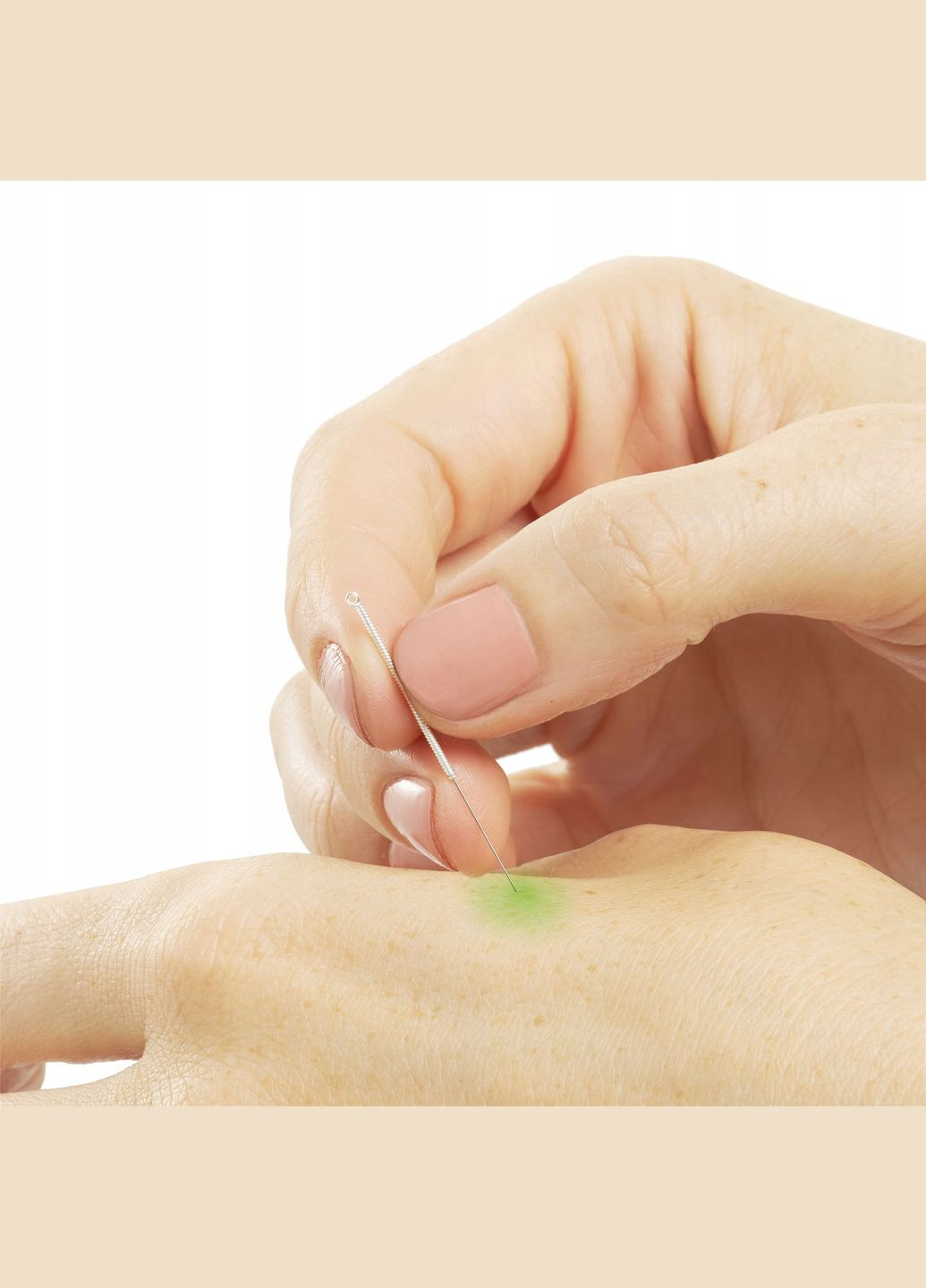 Иглы акупунктурные 0.3 х 75 мм с направляющей 100 шт 4FJ0552 4FIZJO (340108357)