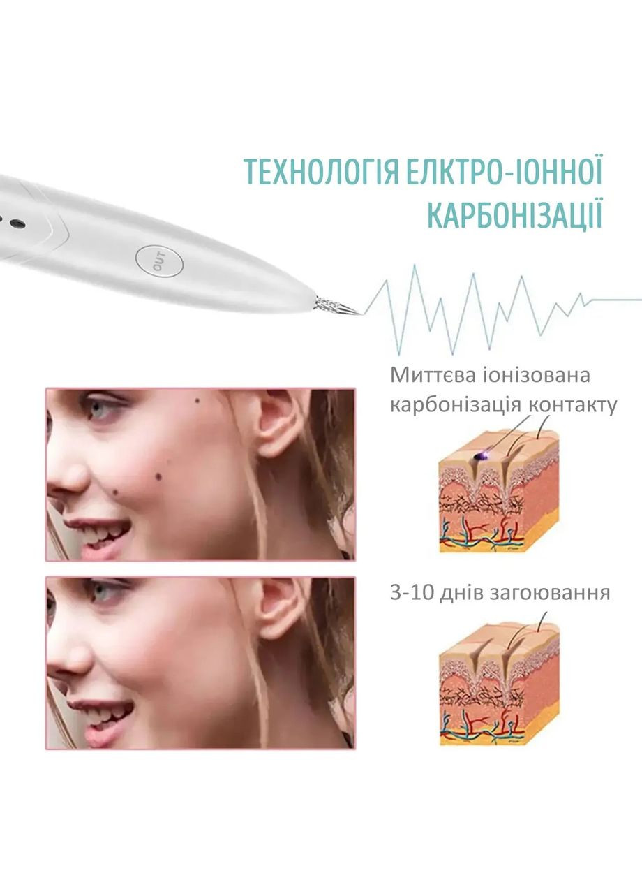 Электрокоагулятор Beauty для удаления папиллом и бородавок плазменная ручка белая Swan YP03 (304274171)