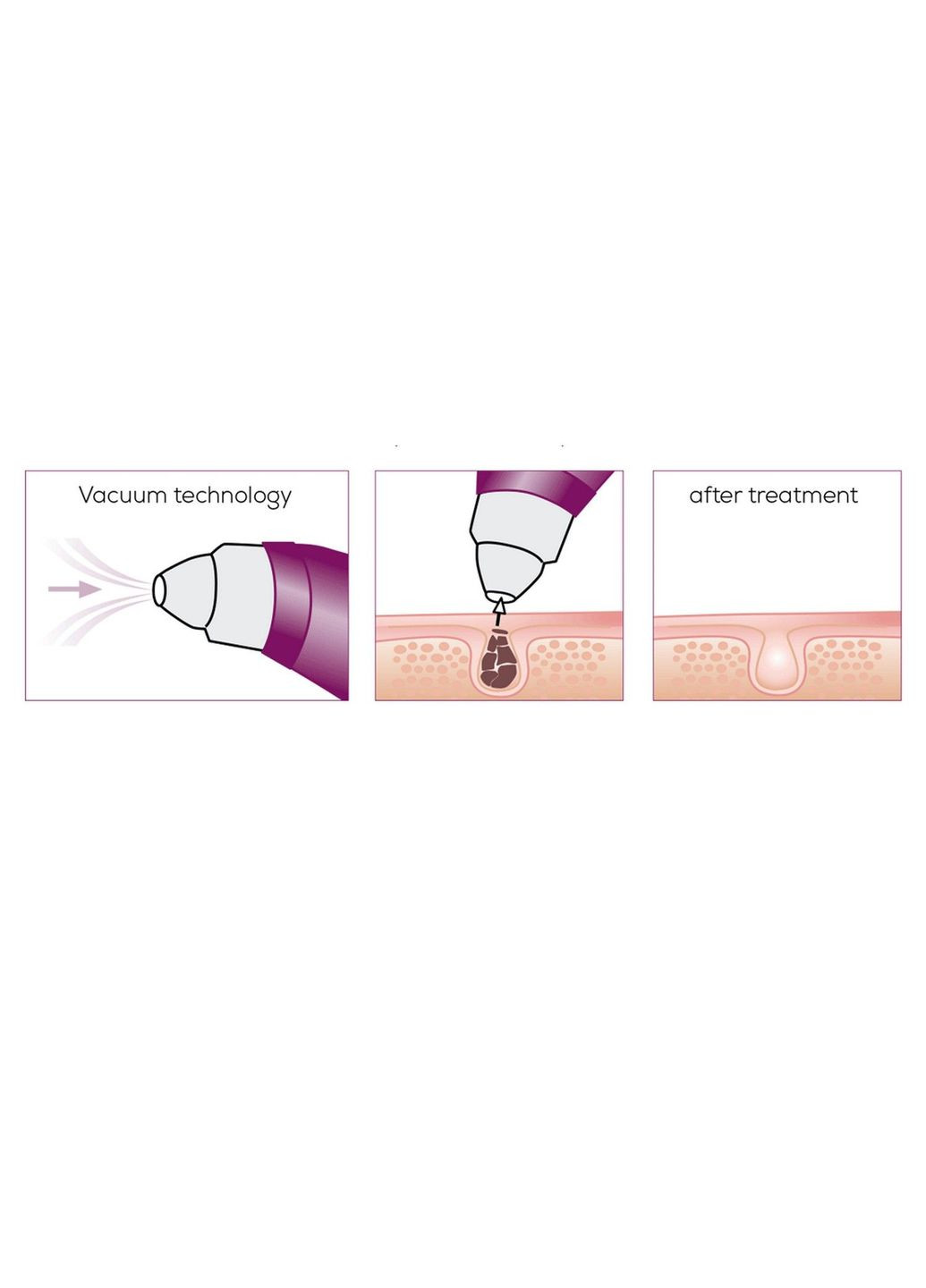 Масажер для обличчя вакуумний, акумулятор, USB, 3 режими, Beurer (315349774)