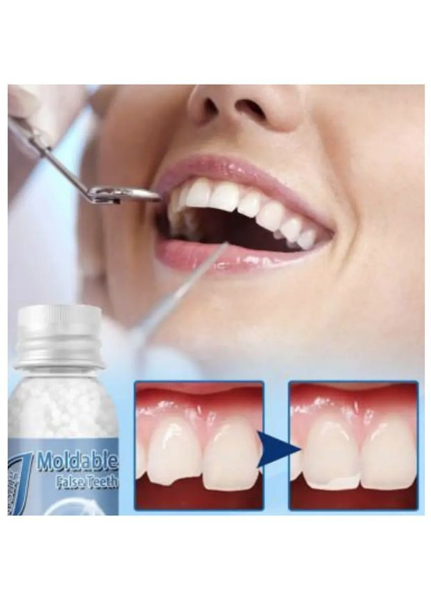 Бусины сменные для зубных протезов вставных, твердый гель, временный клей, 30 мл в флаконе, 1 шт No Brand (365285203)