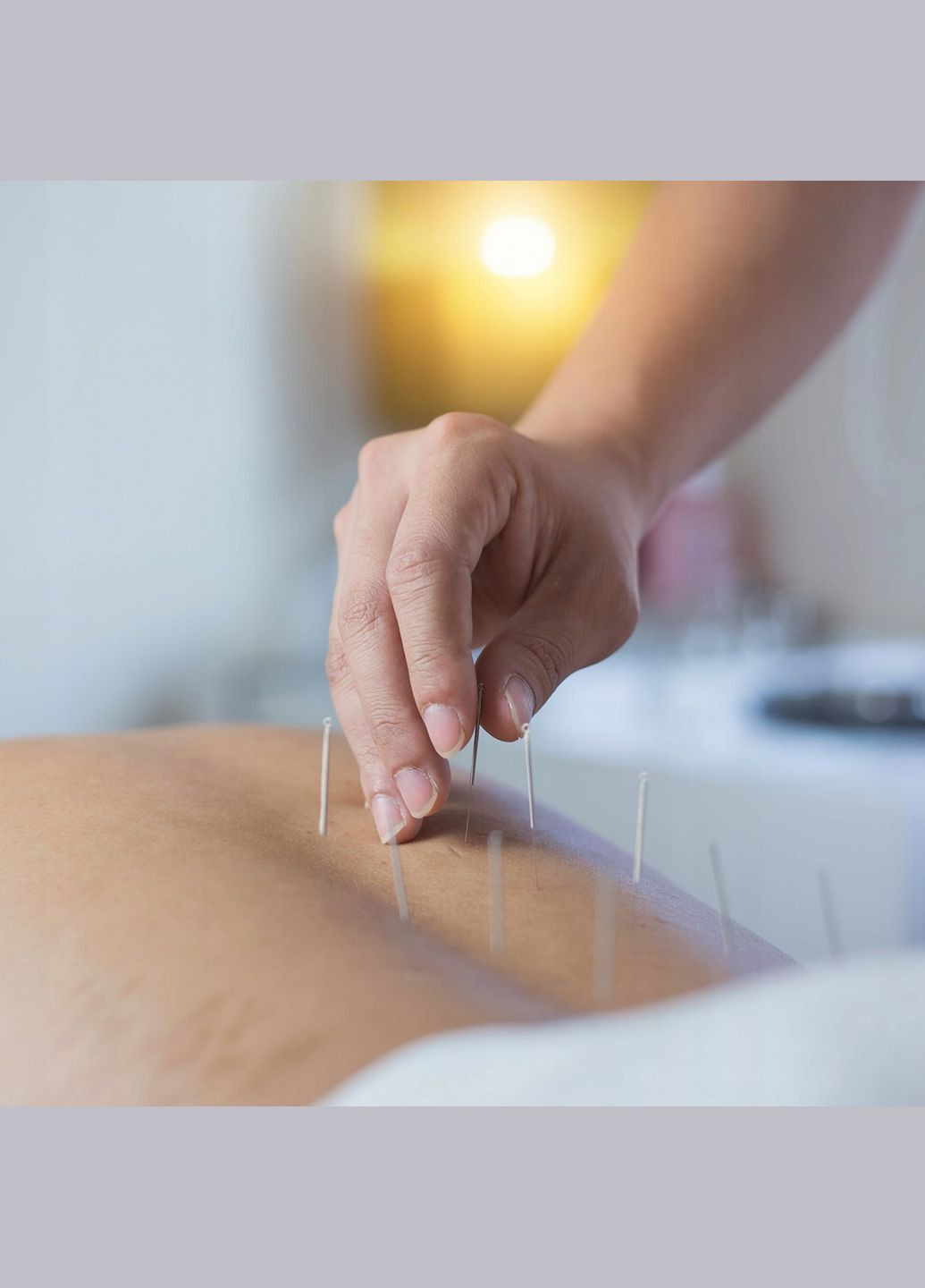 Иглы акупунктурные 0.3 х 75 мм с направляющей 100 шт 4FJ0552 4FIZJO (340108357)