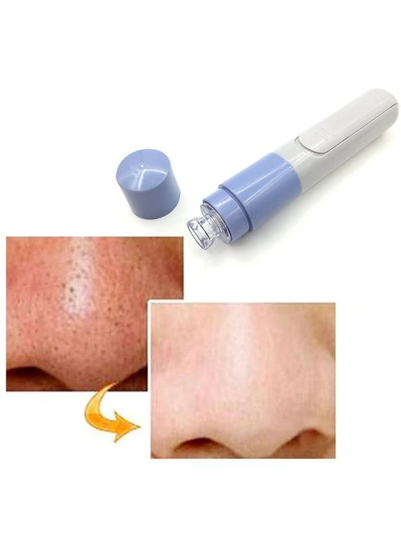 Вакуумний очищувач пор Pore Cleaner Digital (394764899)