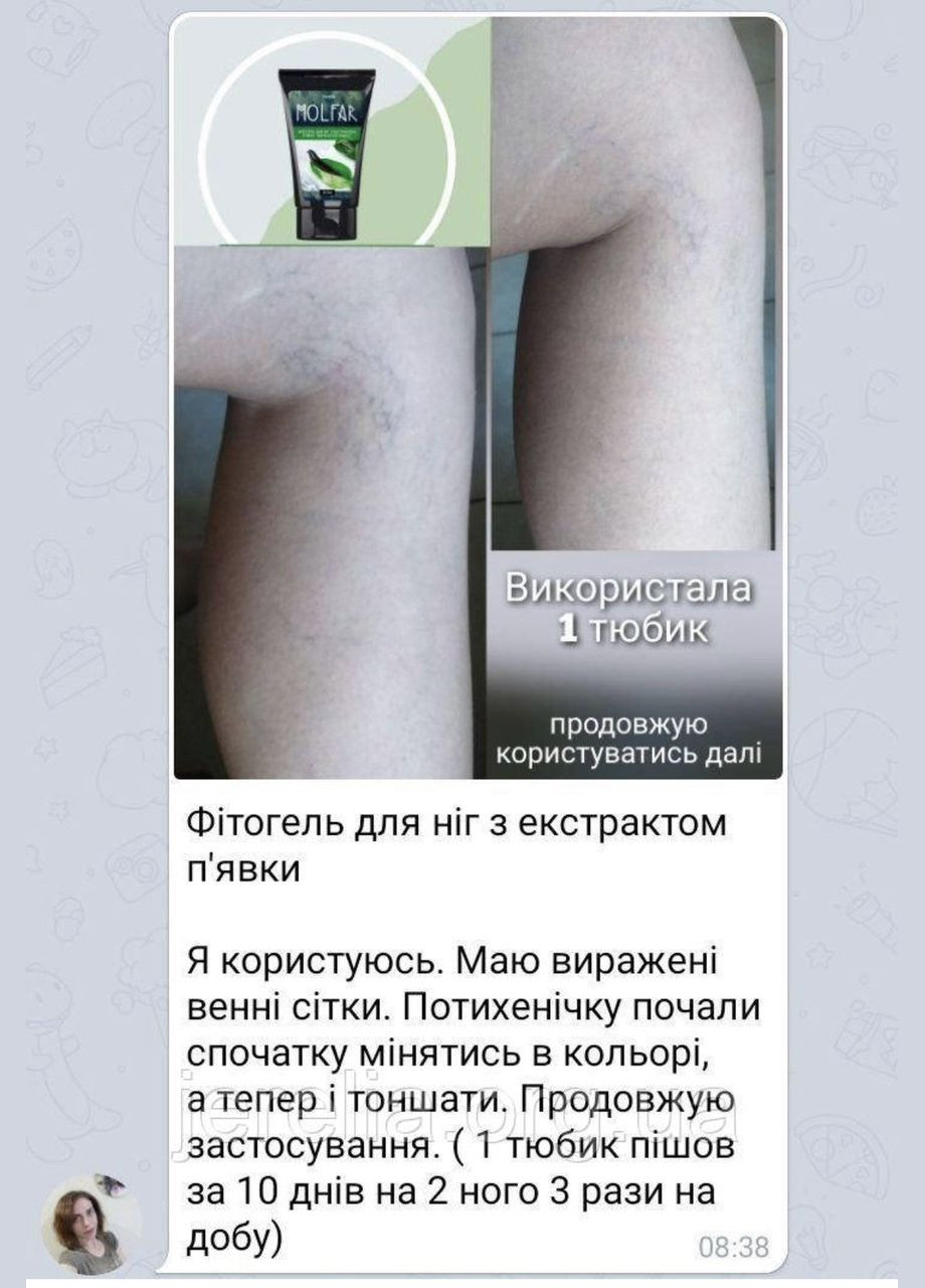 Фитогель для ног с экстрактом пиявки "VARICOSTOP effect" J'erelia (315818262)