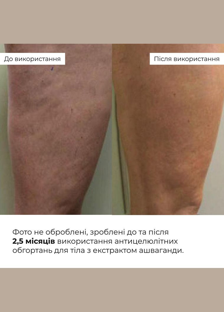 Антицелюлітні моделюючі обгортання для тіла з екстрактом ашваганди Ashwagandha Hot Slim Hillary (340934575)