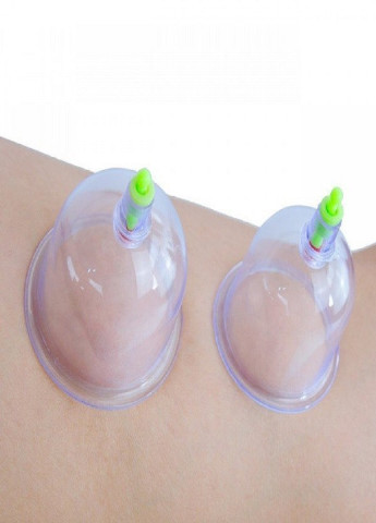 Вакуумний масажер KL PULL OUT A VACUUM APPARATUS Forus (253319227)