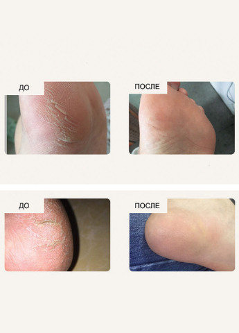 Bioaqua Заживляющий крем с конским жиром Ointment 80г(0164) — Крем, Китай (252548827)