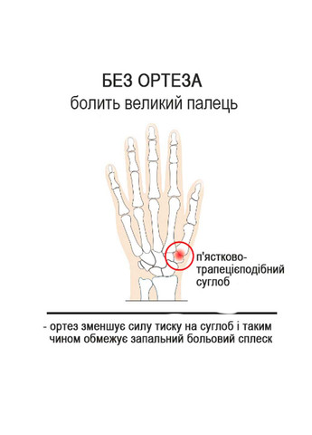 Ортез для большого пальца левой руки гибкий день EP591SX1 S Epitact (276976535)