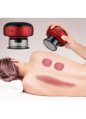 Електричний вакуумний баночний масажер No Brand (261255930)