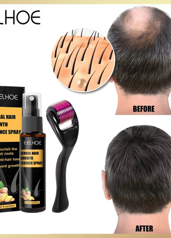 Натуральна олія та валик EELHOE для росту волосся на голові та бороді 30 мл No Brand (277979524)