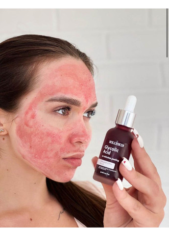 Кислотная сыворотка-пилинг для лица glycolic acid, 30ml Hollyskin (352168475)