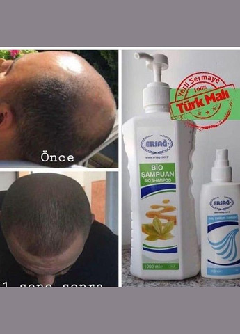 Биошампунь 300 мл ERSAG (329436459)