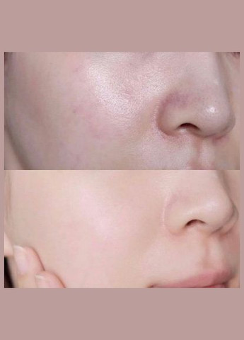 Сыворотка для лица с центеллой и гиалур. кислоты Madagascar Centella Hyalu-Cica Blue Serum, 30 мл SKIN1004 (332052487)