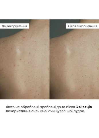 Ензимна очищувальна пудра для жирної та комбінованої шкіри Enzyme Balance Cleanser Powder, 40 г Hillary (387357336)