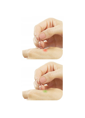 Иглы акупунктурные 0.3 х 30 мм с направляющей 100 шт 4FJ0549 4FIZJO (340108362)