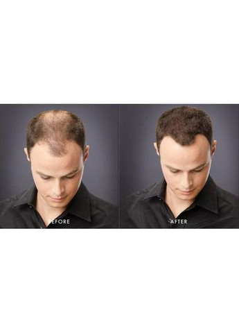 Кератинова пудра для корекції проблемних зон (залисин) 27,5 г Темно-коричневий (Dark Brown) Toppik (302450979)