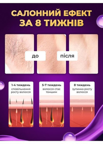 Фотоэпилятор женский лазерный эпилятор с функцией охлаждения компактный 5 уровней интенсивности для эпиляции Medica+ 08 (362412382)