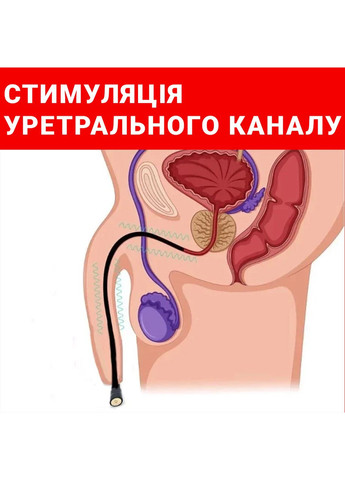 Катетер для расширения уретры бдсм 11мм толщина аксессуар для мужчин уретральный стимулятор No Brand (363265356)