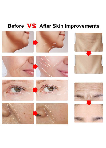 Аппарат HIFU RF LiftPro многофункциональный антивозрастной массажер для лица с микротоками Mini (325261094)