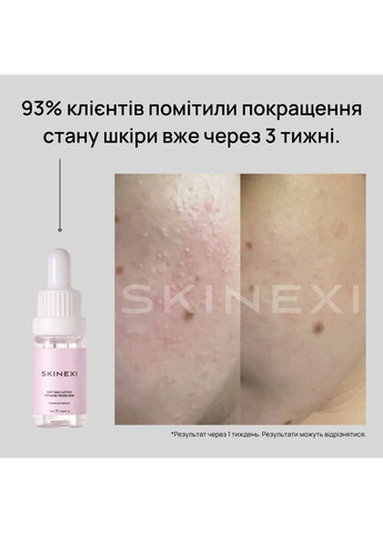 Лосьон для проблемной кожи от комедонов и чёрных точек Soft Daily Lotion Skinexi (365284453)