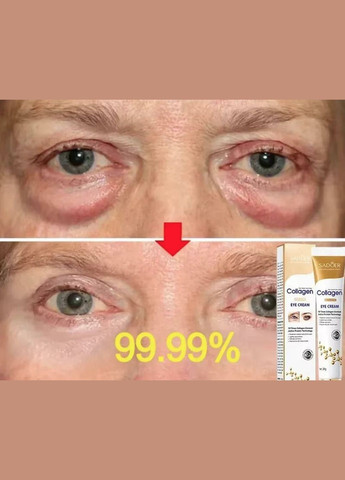 Крем для видалення мішків, кіл, зморшок, набряклості, освітлення шкіри під очима, флакон 20 г, 1 шт No Brand (335413521)